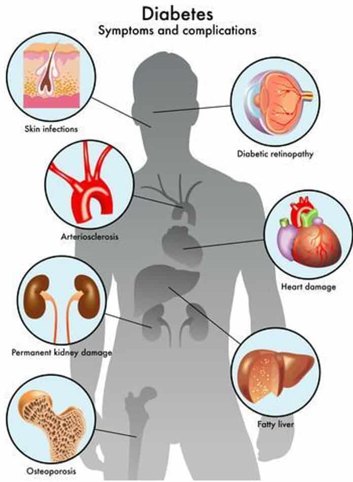 Diabetes symptoms and complications