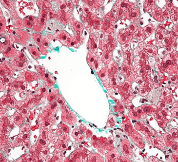 Kupffer cells working on a liver injury