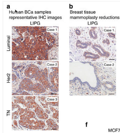 Controlling this fat stops cancer