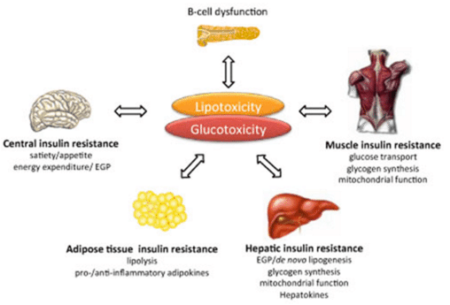 Here's what really causes diabetes (and what fixes it)