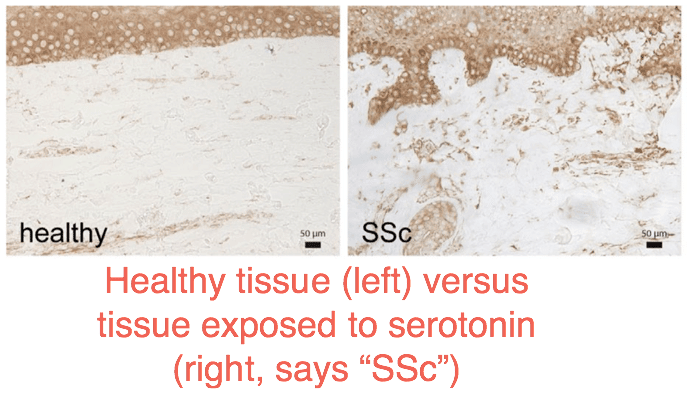 Healthy tissue versus tissue exposed to serotonin