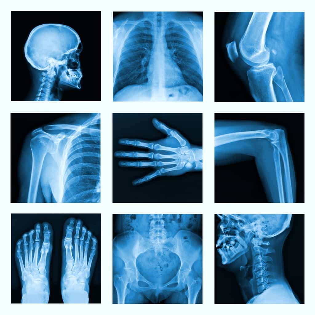 X-rays really are harmful