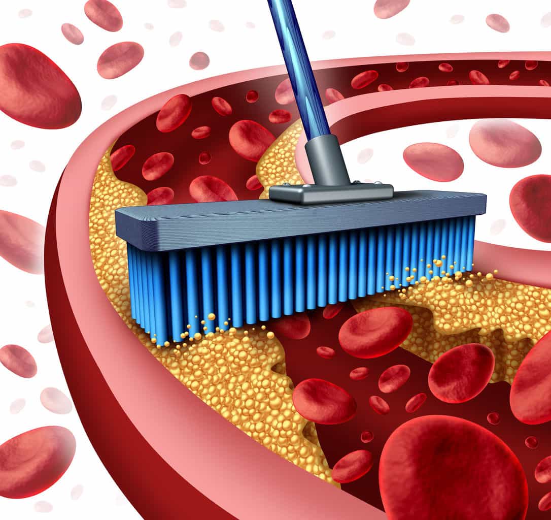 Lowering cholesterol has no beneficial effects Lowering cholesterol has no beneficial effects