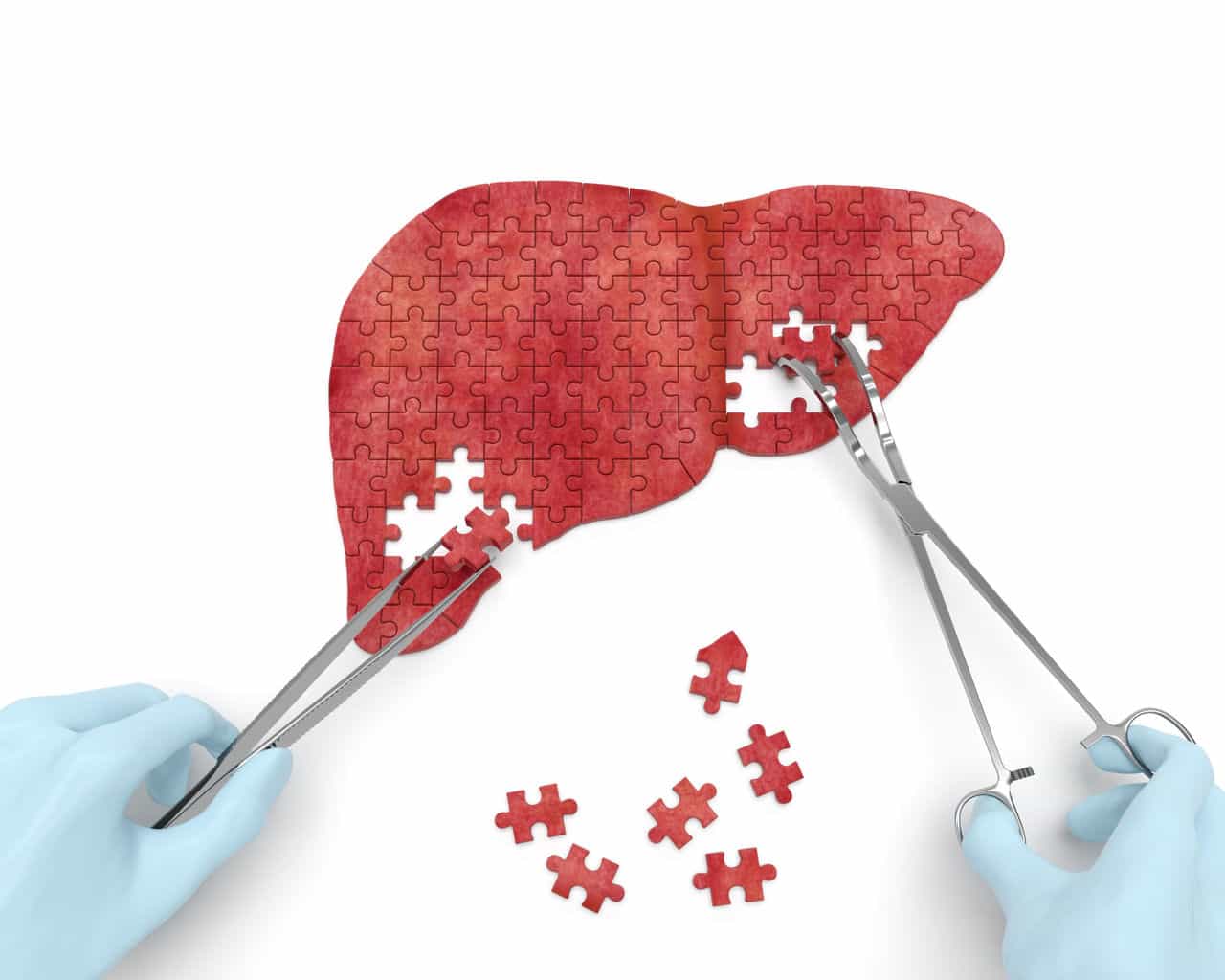 Is your liver affecting your health?