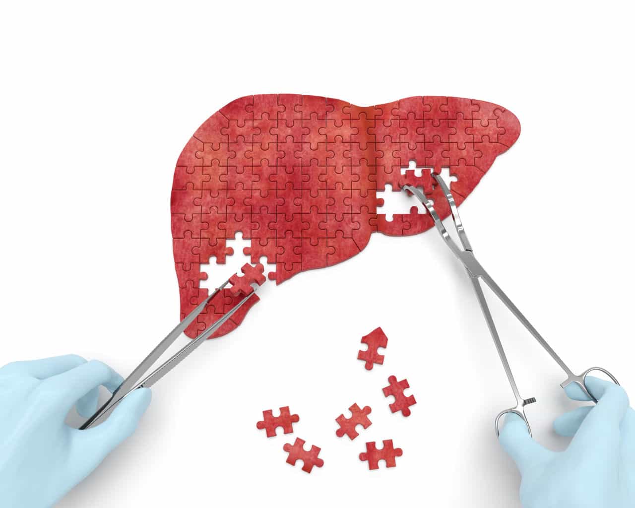 Is your liver affecting your health? Is your liver affecting your health?