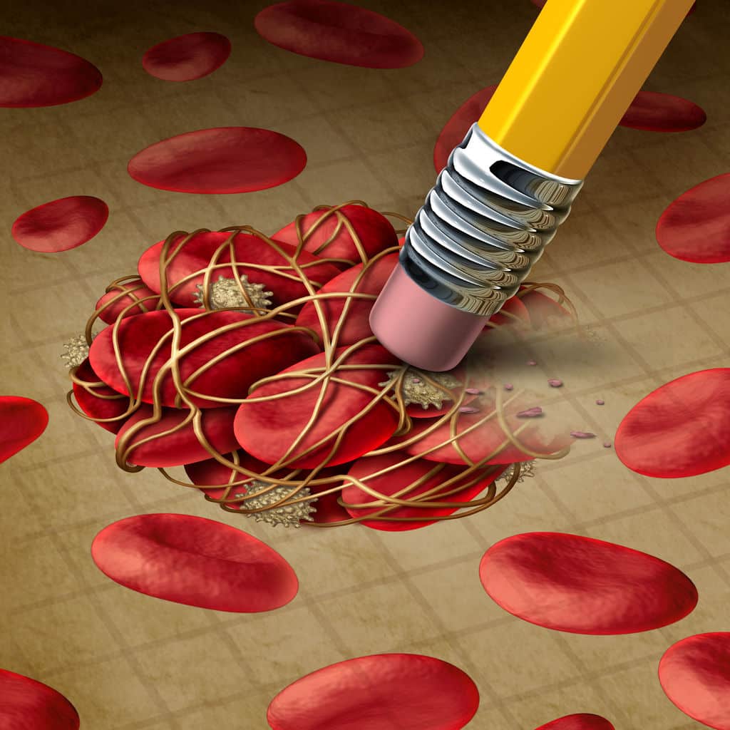 What causes prostate inflammation What causes prostate inflammation