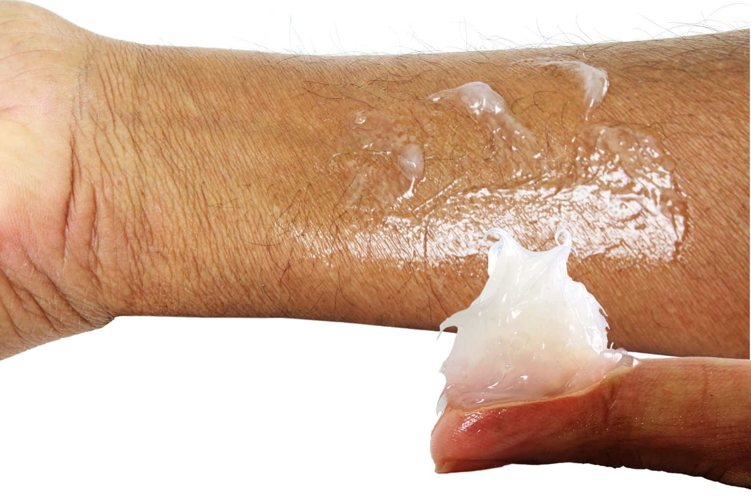 Reversing the bad effects from cortisone cream and pills Reversing the bad effects from cortisone cream and pills