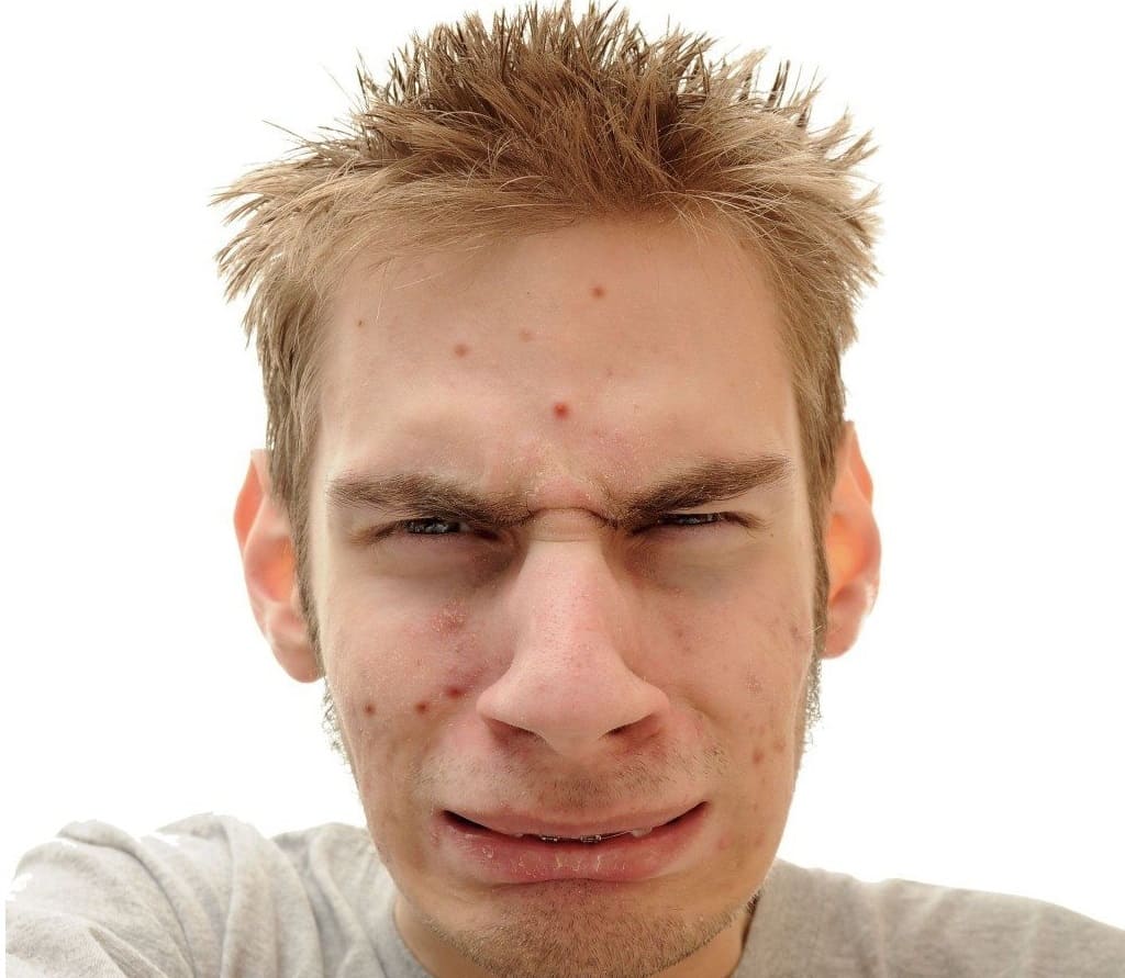 Can gut problems cause acne and diabetes?