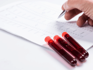 Test tubes with blood on white table with test chart and ballpoint pen