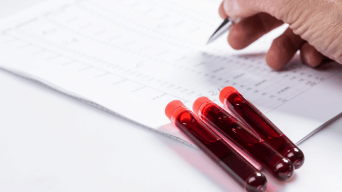 Test tubes with blood on white table with test chart and ballpoint pen