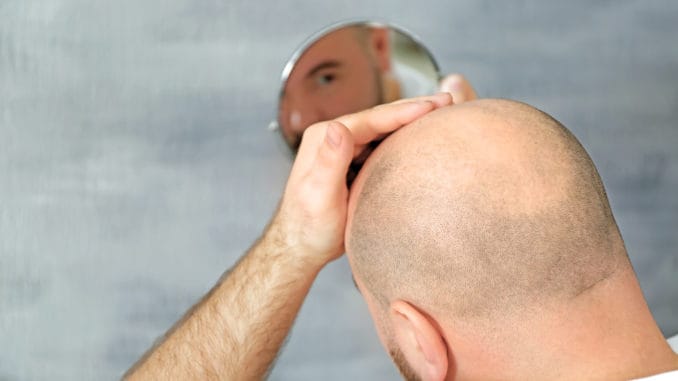 Too Much of This Vitamin Can Cause Hair Lossg in mirror at home Too Much of This Vitamin Can Cause Hair Loss