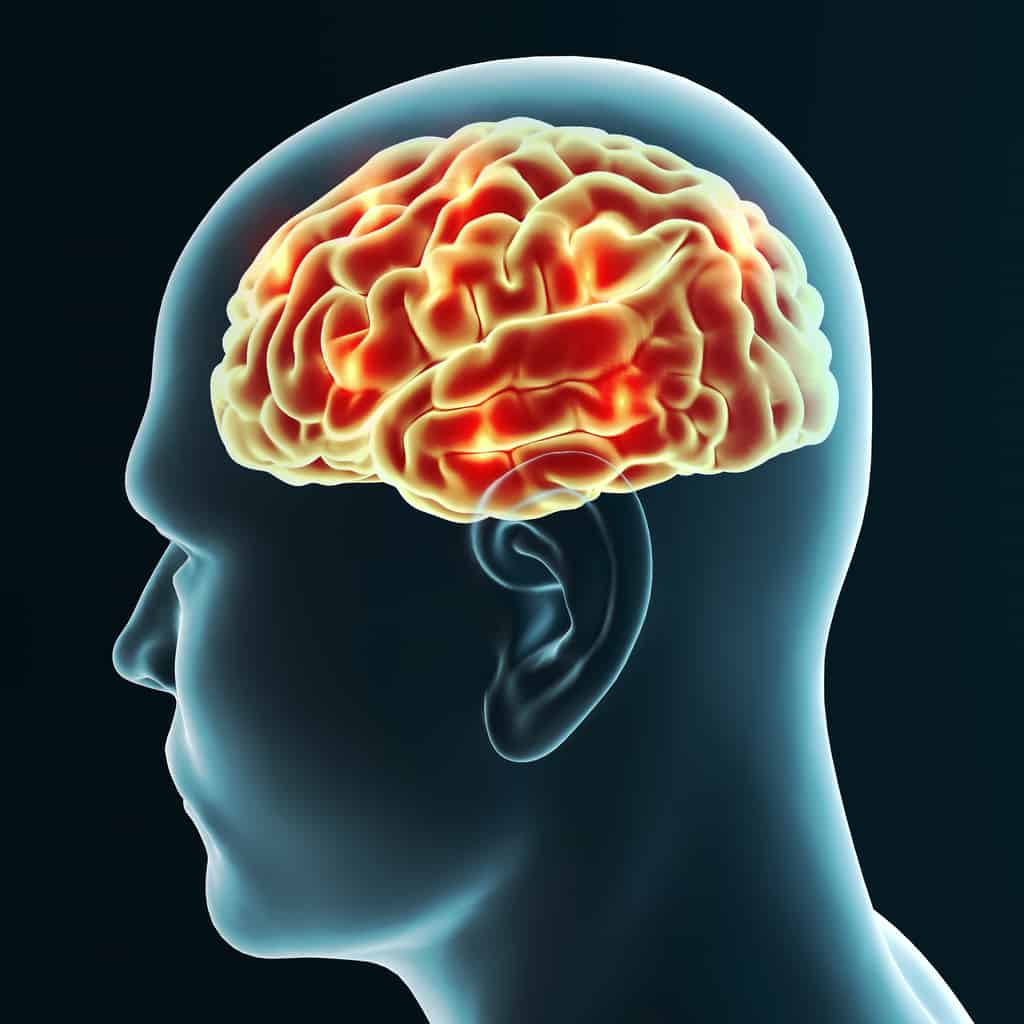 Prevent iron buildup in the brain - new Iron Breakthrough Prevent iron buildup in the brain - new Iron Breakthrough