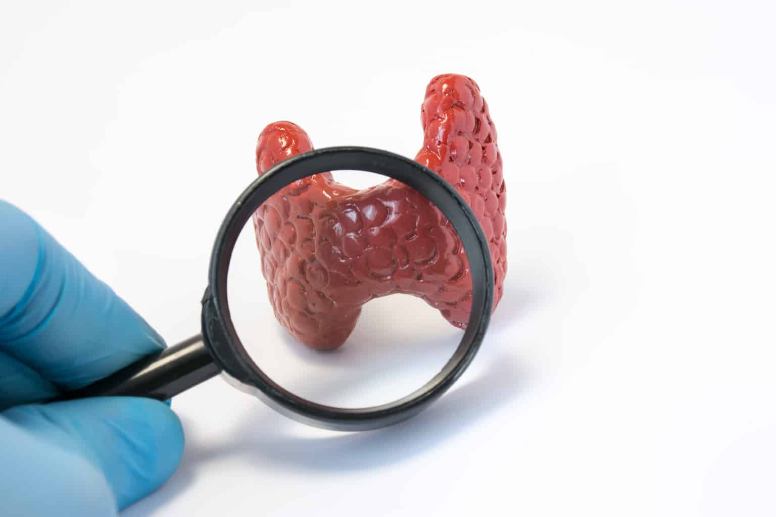 The penile signs of a thyroid disorder The penile signs of a thyroid disorder