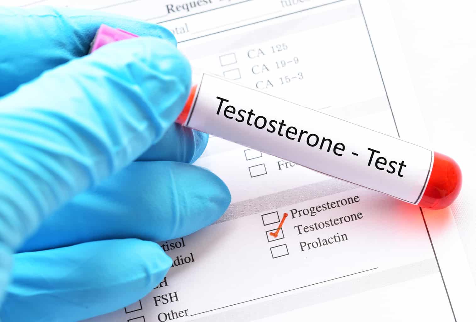 A 44% testosterone boost A 44% testosterone boost