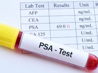 Read This Before Getting a PSA Test (Very Important)