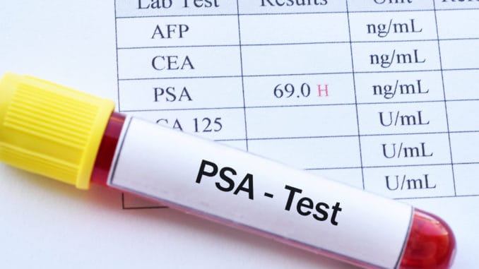 Read This Before Getting a PSA Test (Very Important) Read This Before Getting a PSA Test (Very Important)