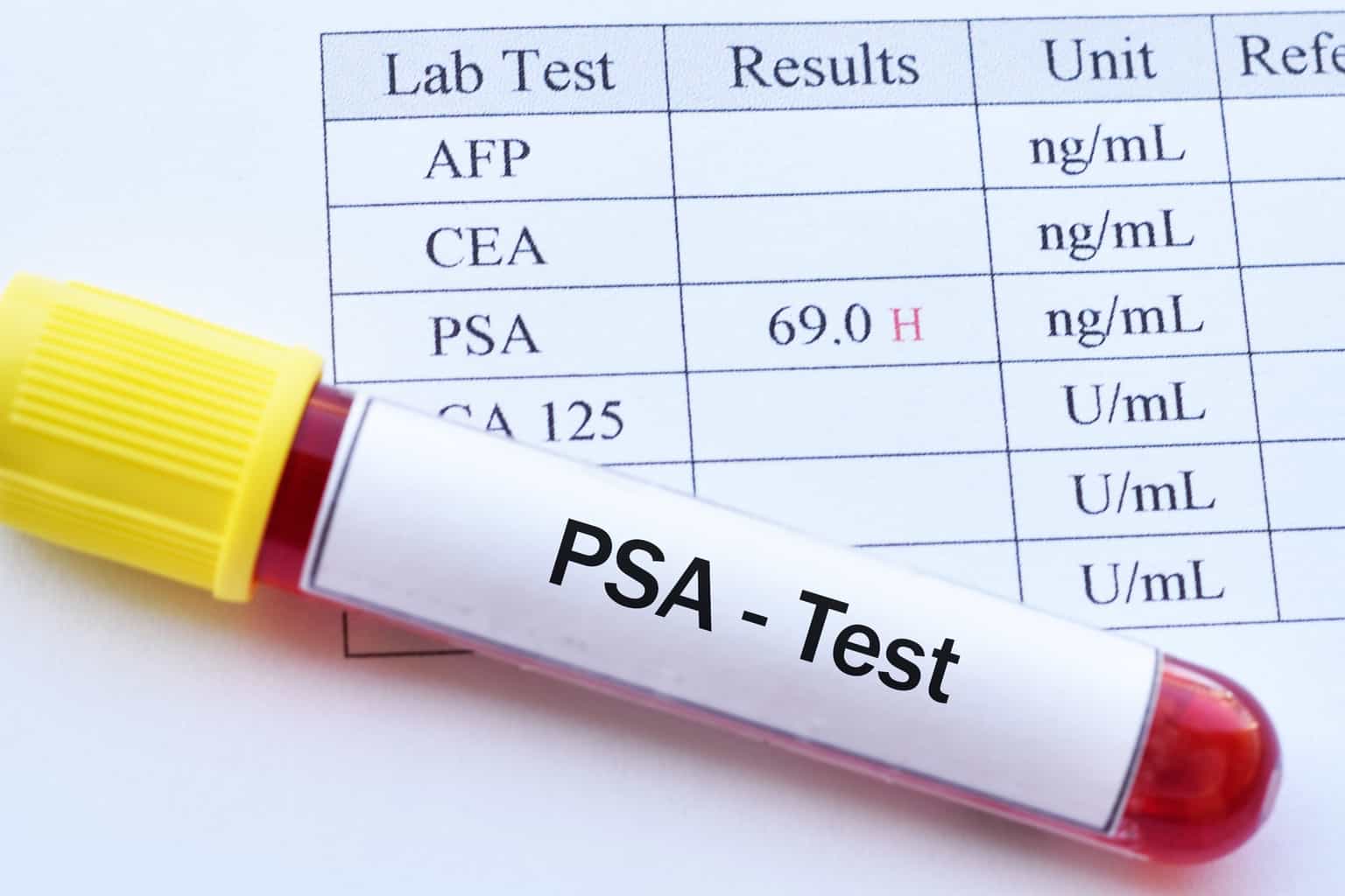 What Does A PSA Test Result Of 6 Mean?