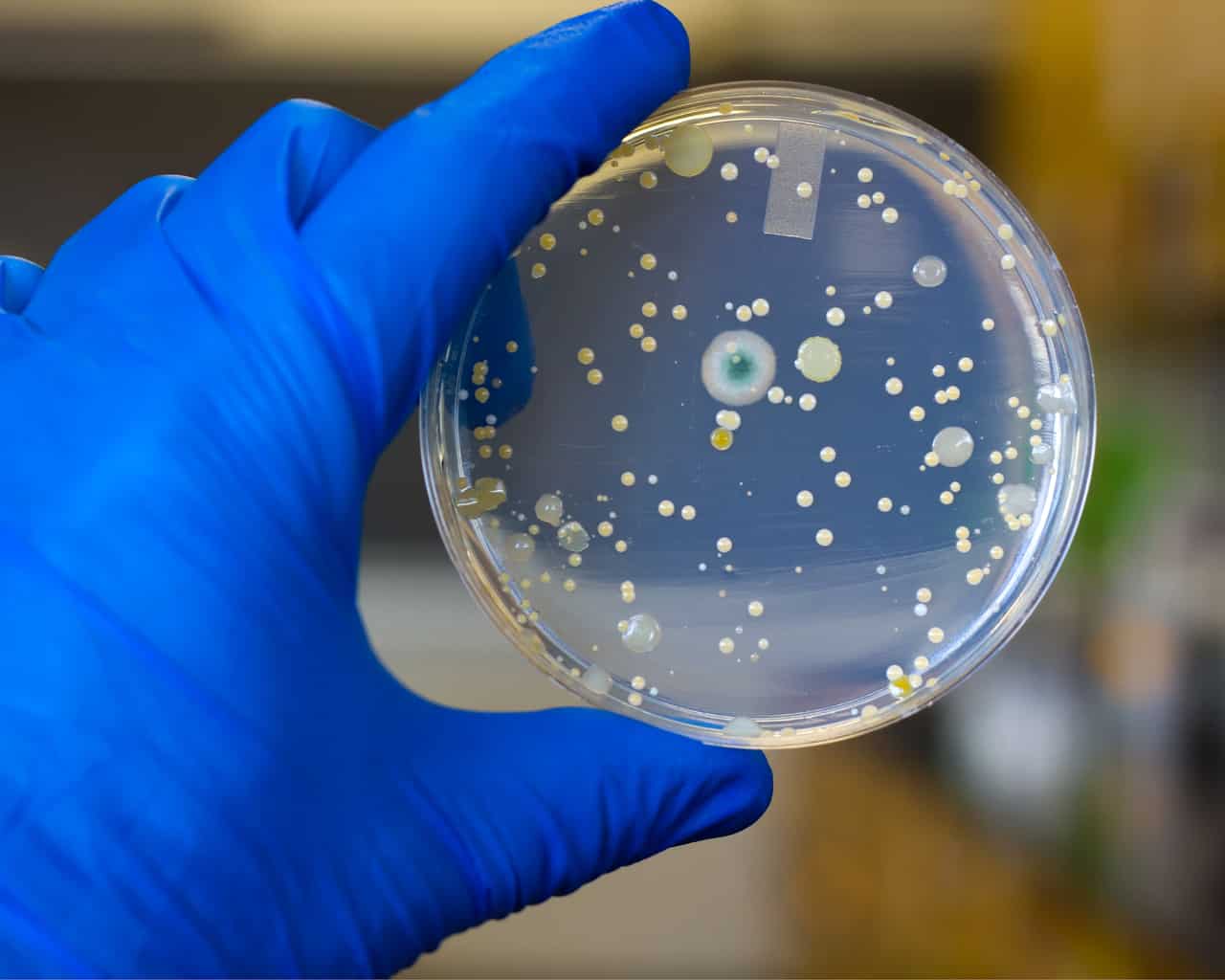 Superbugs: How to tell you’ve been infected