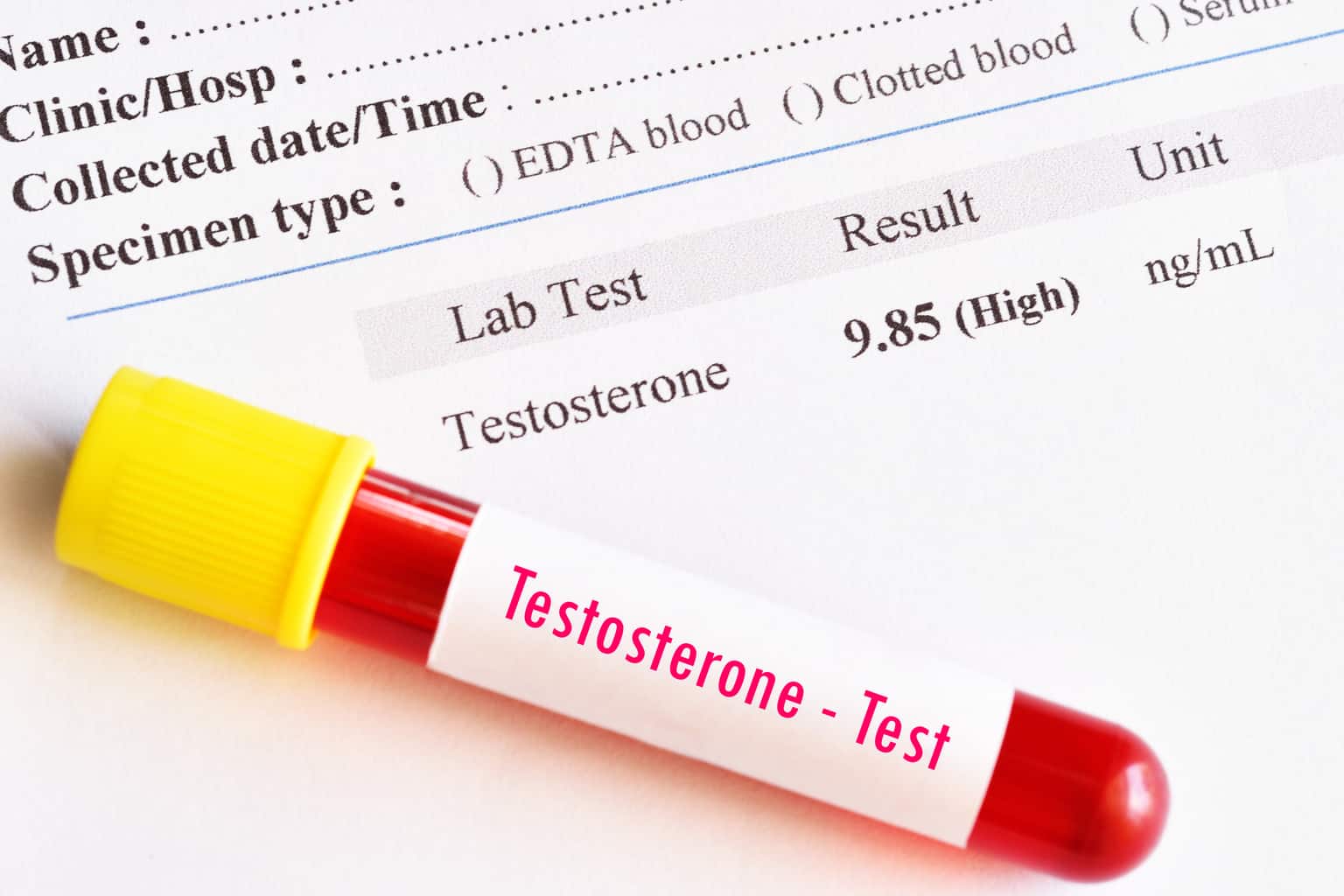 Brazilian Study: Now All Men Can Have High Testosterone