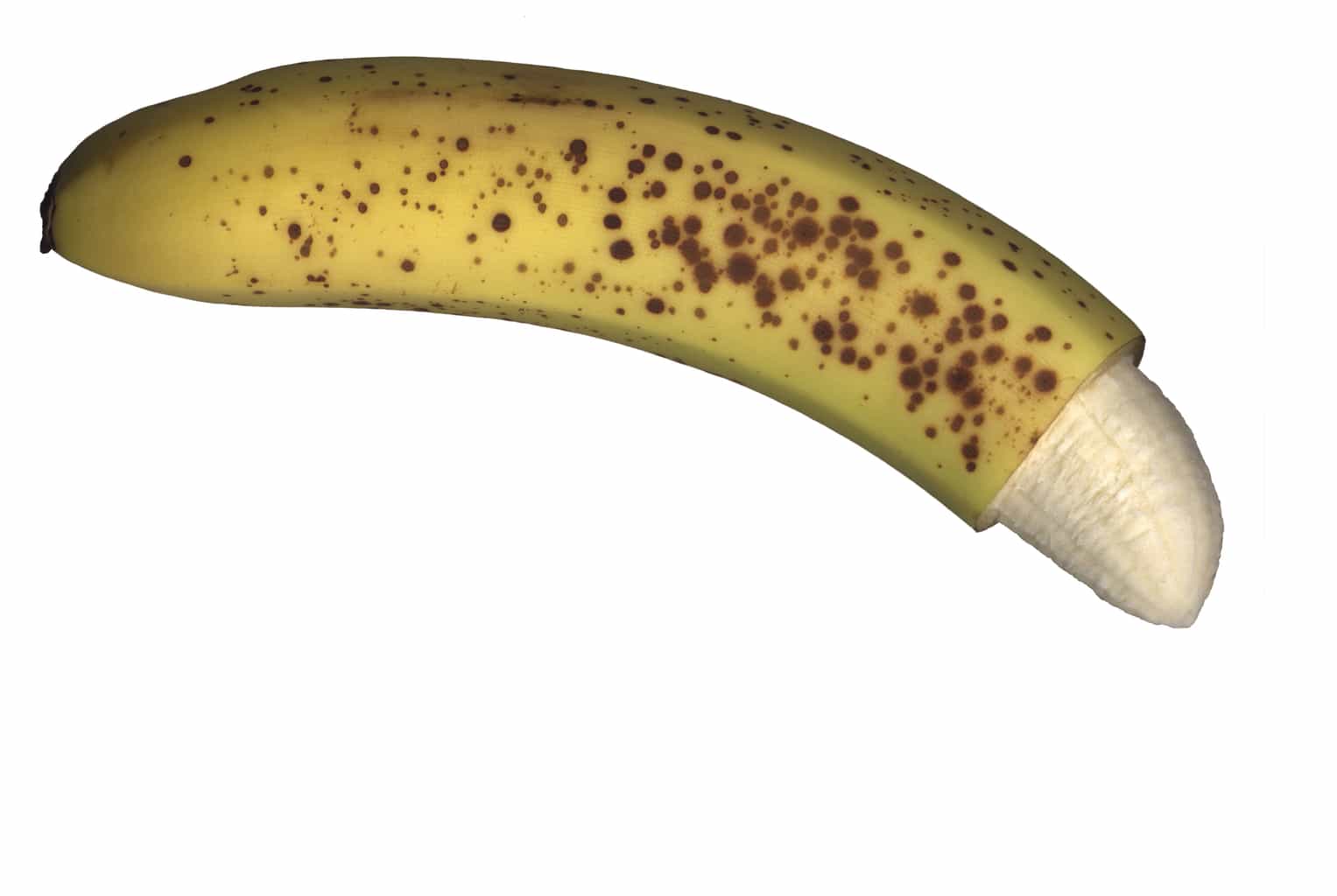 Does Circumcision Cause Sexual Problems? Does Circumcision Cause Sexual Problems?