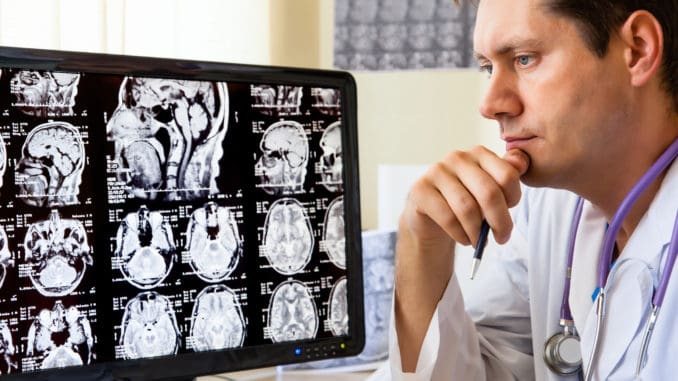 dreamstime_m_25297416 Doctor in hospital looking at ct scan