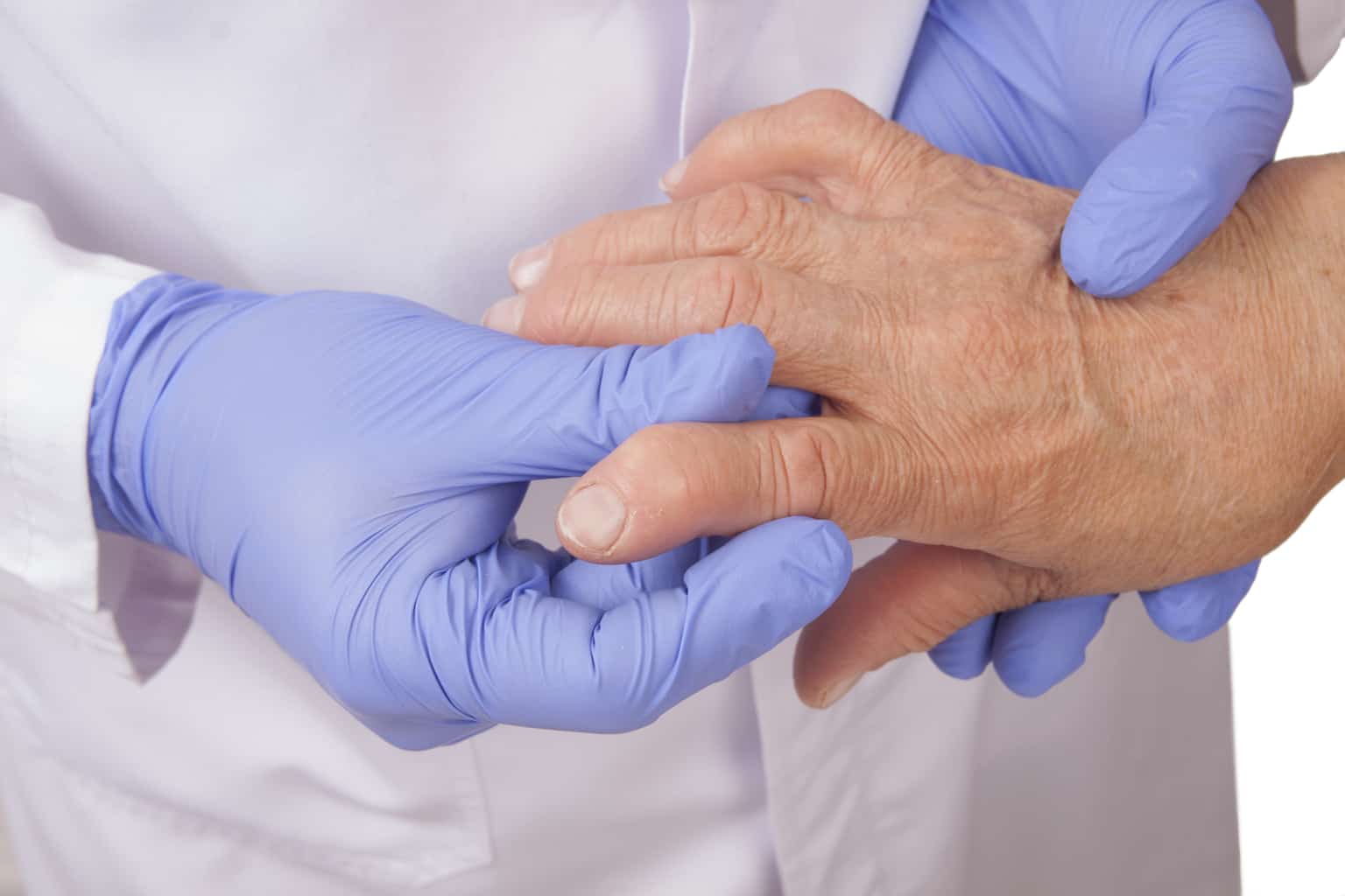 What really causes arthritis What really causes arthritis