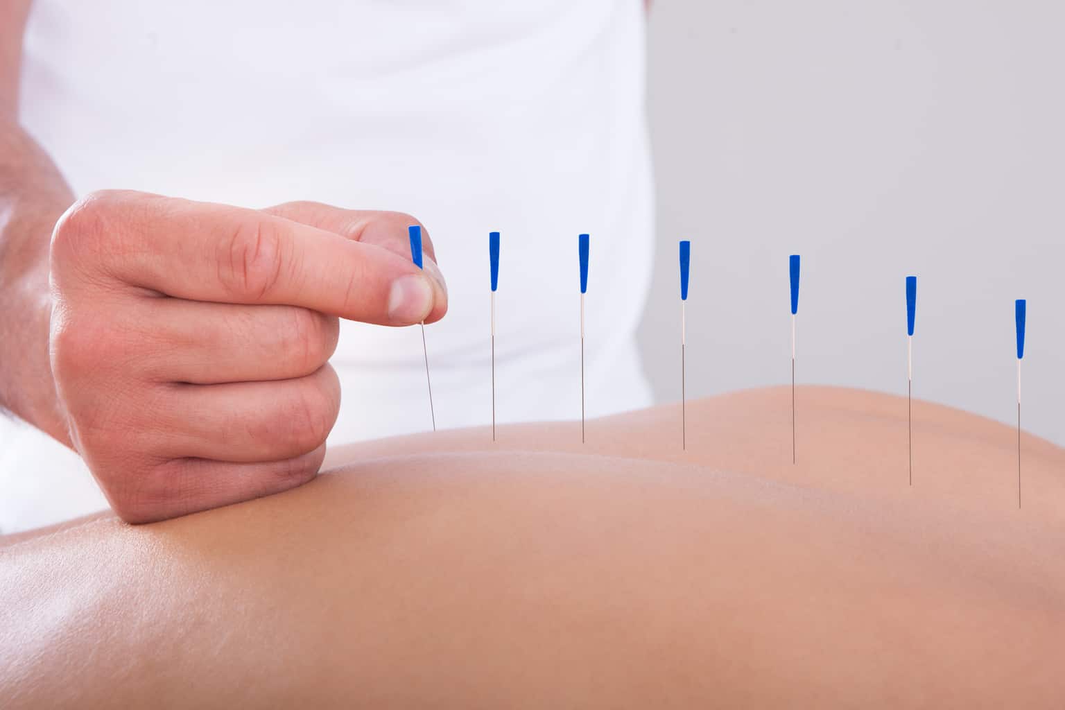 Can acupuncture really reduce nerve pain and inflammation?
