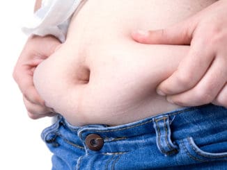 Obese patient on white background