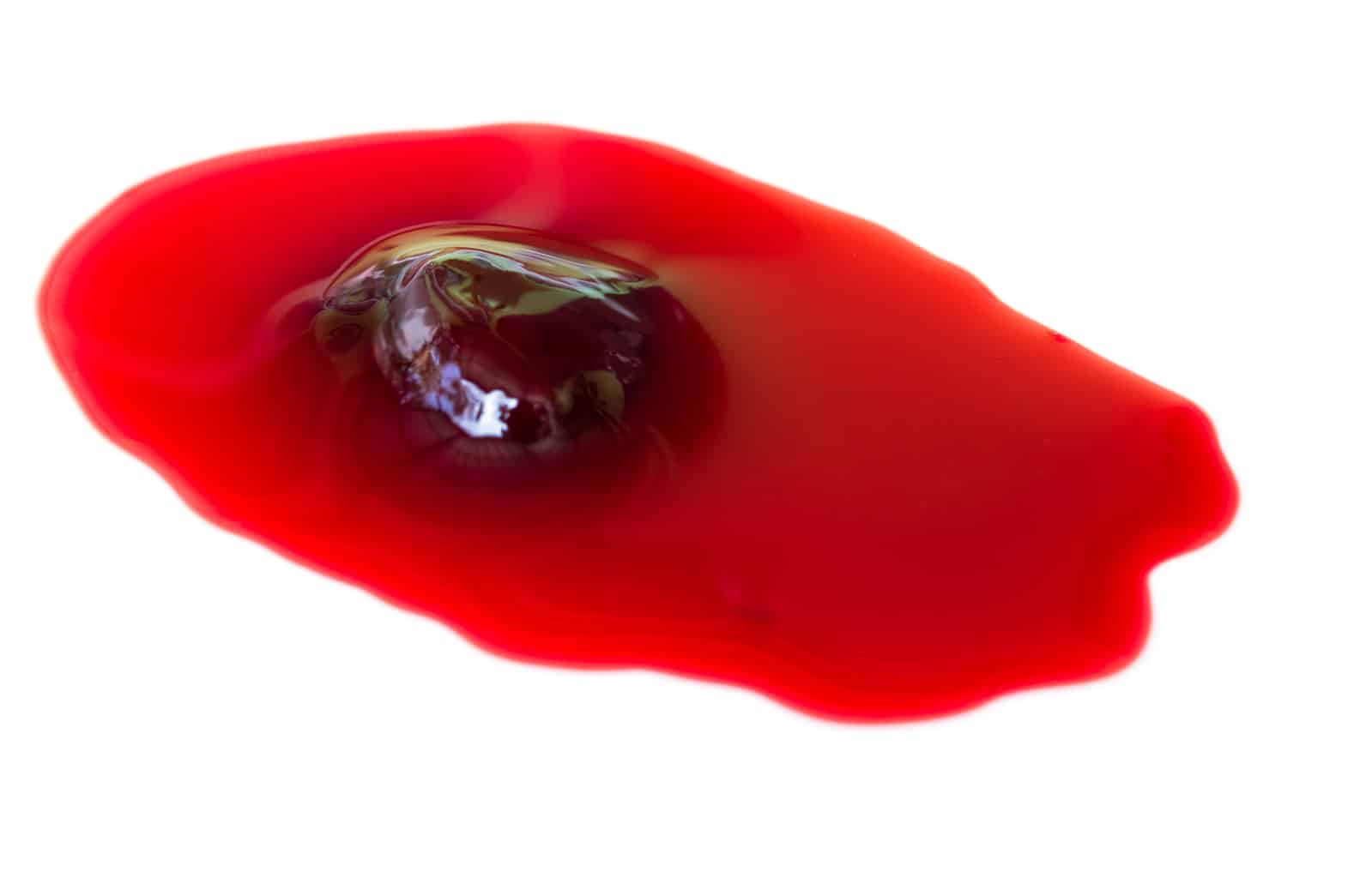 The No.1 warning sign that you may have a blood clot
