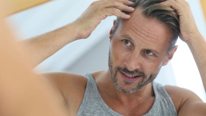 Middle-aged man concerned by hair loss