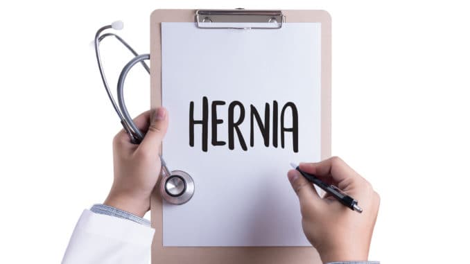 Men -- lower your estrogen levels this way to prevent painful hernias