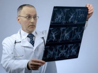 Experienced cardiologist checking CT scan of blood vessels, looking surprised, stock photo