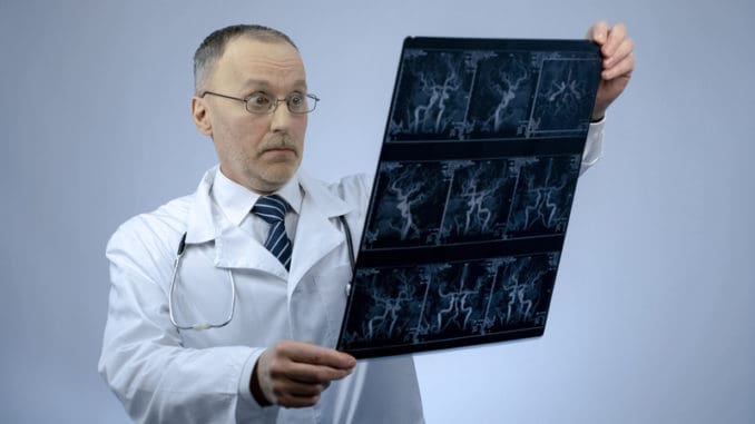 Experienced cardiologist checking CT scan of blood vessels, looking surprised, stock photo