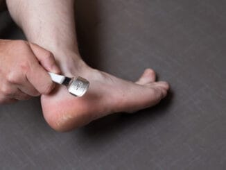Man removing corn, callus from his feet using a razor file, masculine skin care, skin disease, fungal infection, skin treatment and healthcare, close up, caucasian, not recognizable