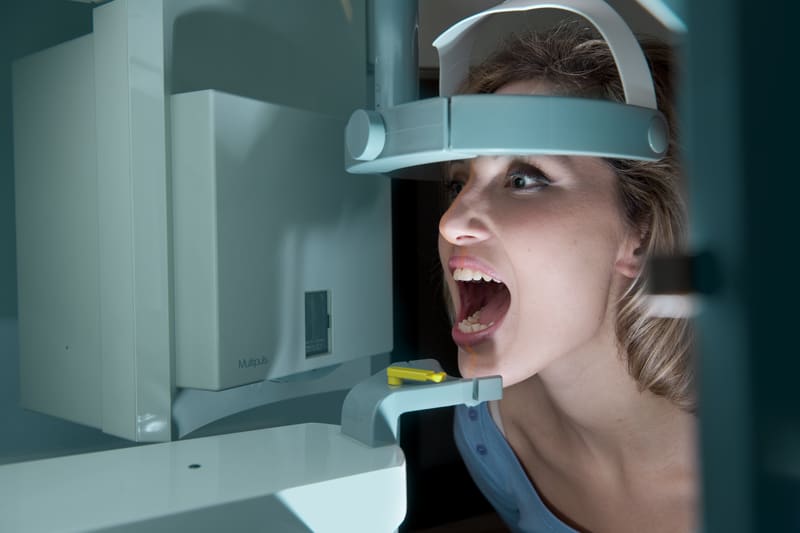 Why I always refuse to get dental x rays Daily Medical Discoveries