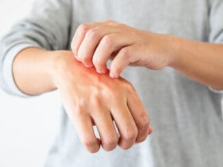 Young asian man itching and scratching on hand