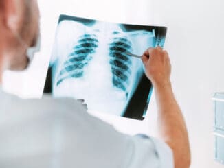 Male doctor examining the patient chest x-ray film lungs scan