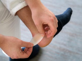 Painful Heel wound on mans feet caused by new shoes.