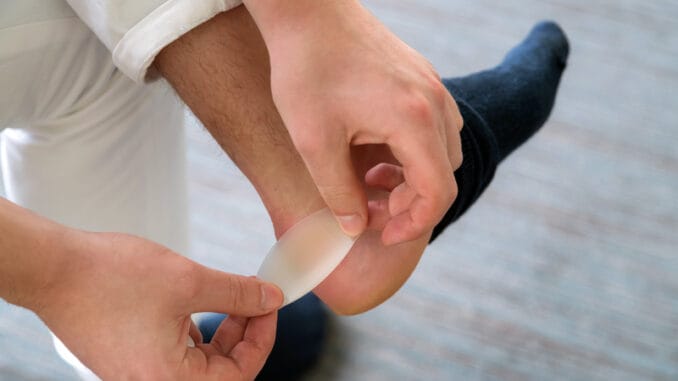 Painful Heel wound on mans feet caused by new shoes.