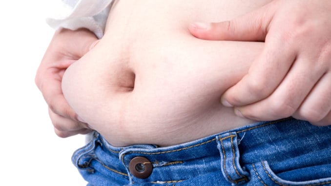 Obese patient on white background