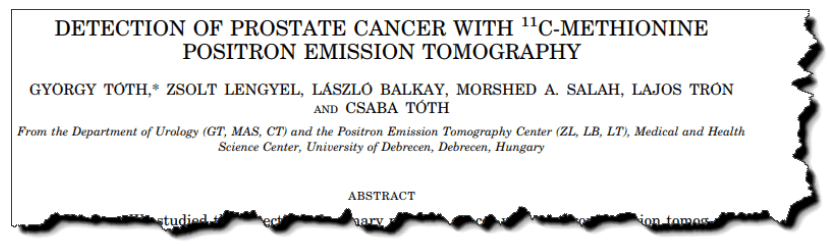 Detection of prostate cancer with 11C-methionine positron emission tomography.