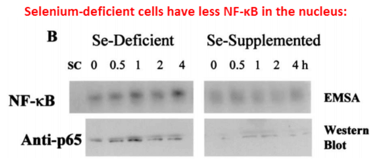 Selenium-deficient cells have less NF-KB in the nucleus