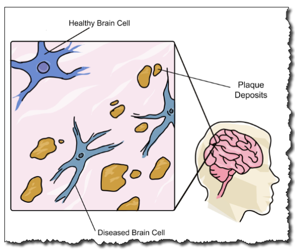 Brain cells